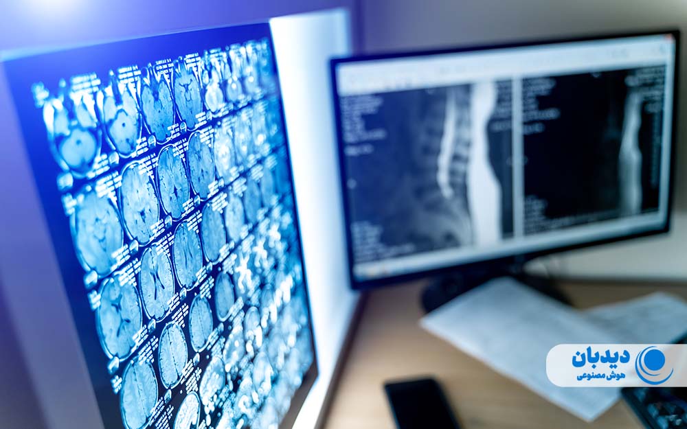 آسانسورهای شیشه ای  
